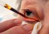 Рекомендации врача по удалению катаракты: до и после операции